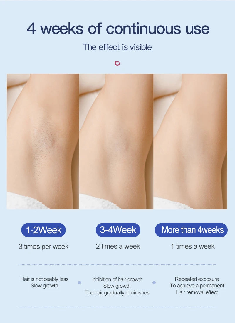Rechargeable Laser Hair Removal Sapphire Cooling Auto Permanent Painless Bikinis Trimmer in Home Icy Cold Wireless IPL Epilator