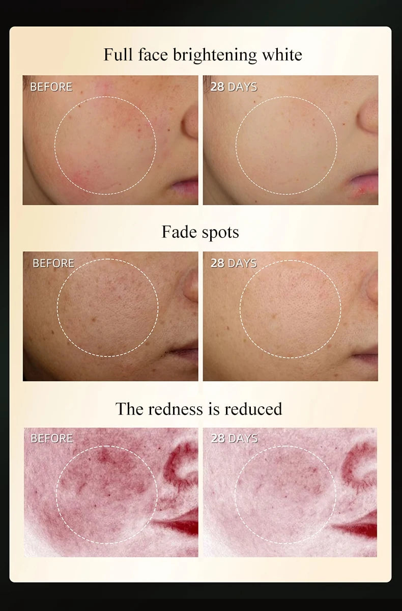 DPL skin rejuvenation photorejuvenation skincare device IPL Anti-Aging Device for Face Wrinkle Removal Pigment Removal Home Use