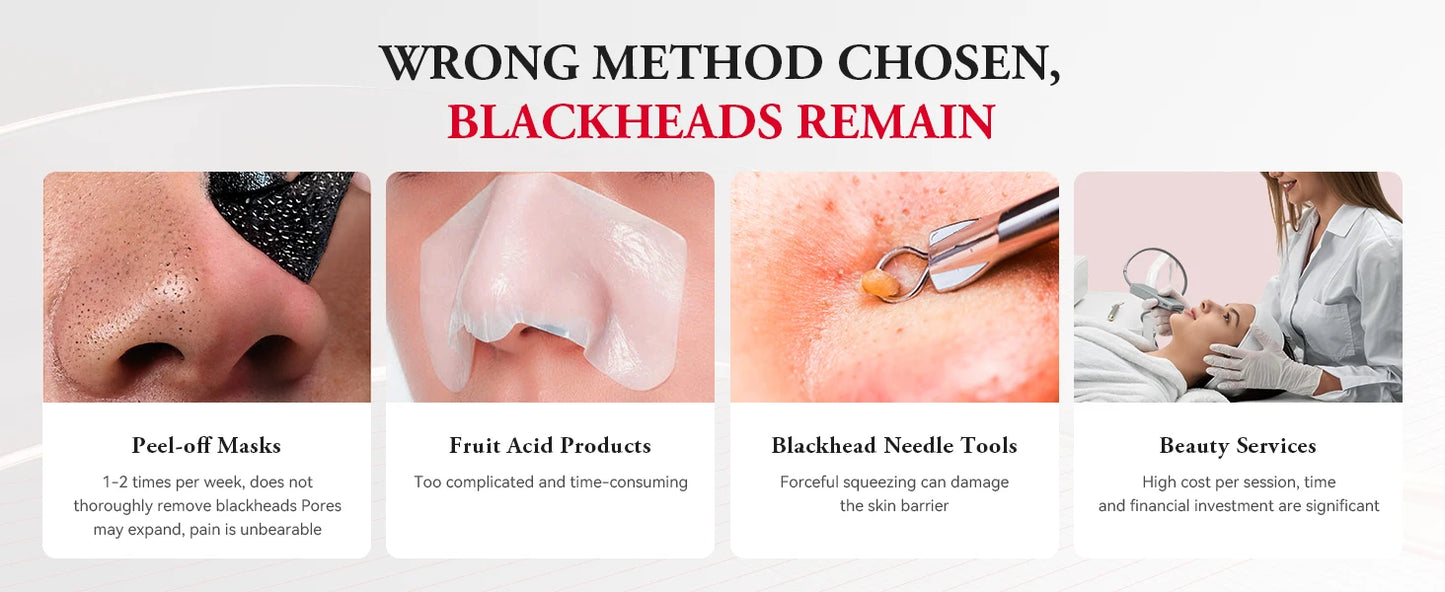 ANLAN Electric Water Vacuum Blackhead Remover Pore Cleaner Facial Hydro Cleanse Skincare Device for Whitehead And Acne Suction