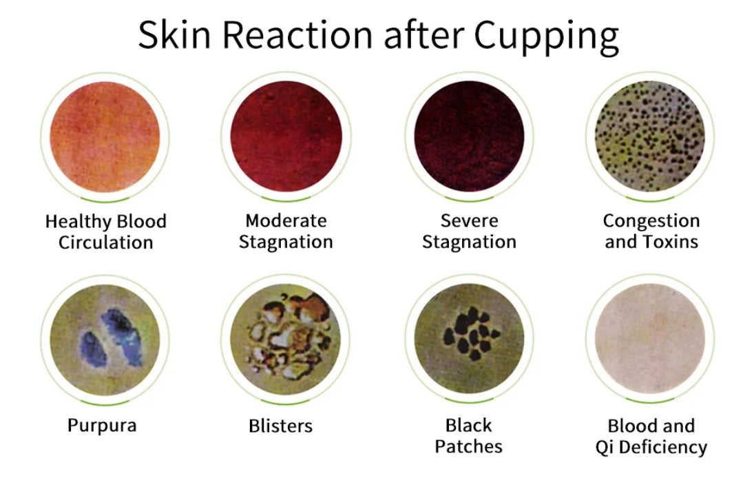 Vacuum Cupping Sets with Pumping Gun Suction Cups Back Massage Body Cup Detox Anti Cellulite Therapy Cans Healthy Care Jars