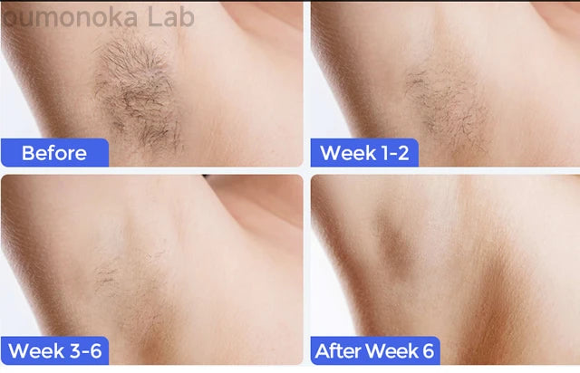 IPL Hair Removal Device 999999 Flashes  Permanent Epilator Body Treament Home Use for Women Men Facial Shaver Cutting Machine