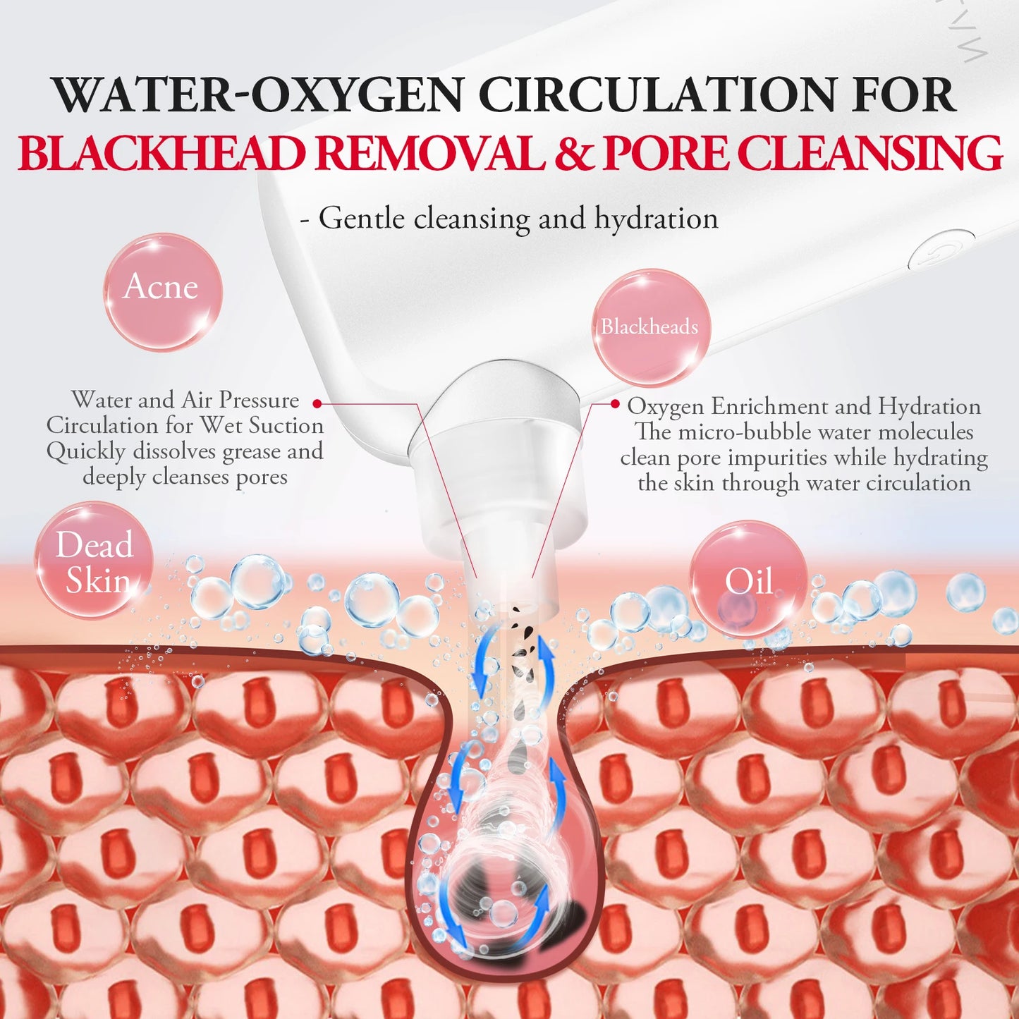 ANLAN Electric Water Vacuum Blackhead Remover Pore Cleaner Facial Hydro Cleanse Skincare Device for Whitehead And Acne Suction