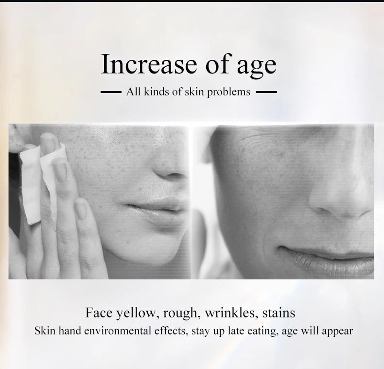 DPL skin rejuvenation photorejuvenation skincare device IPL Anti-Aging Device for Face Wrinkle Removal Pigment Removal Home Use