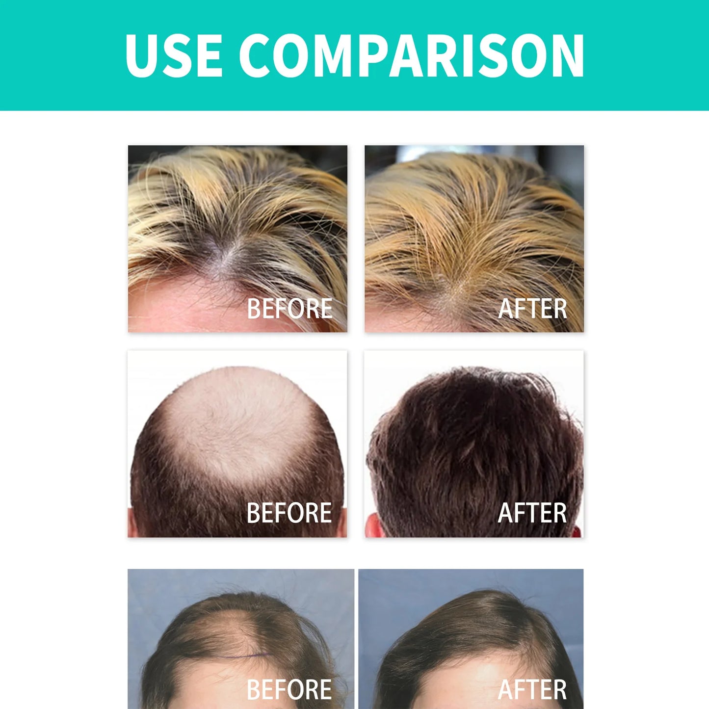 Dense Hair Ball Essence Thick Hair Root Strong Hairline Firm Hair Prevent Hair Loss Hair Care Serum Oil Hair Growth Roller