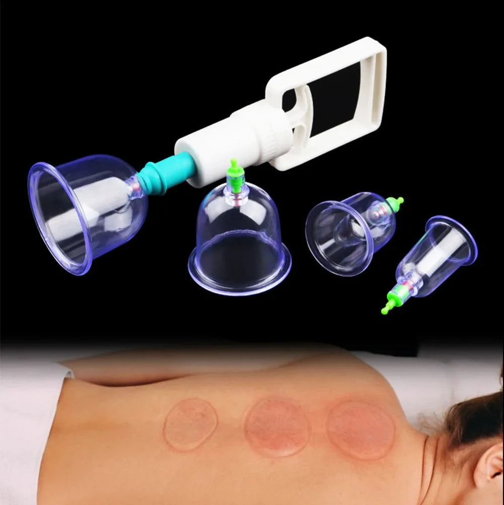 12/6Pcs Vacuum Cupping Set Suction Cups Back Massage Body Cup Detox Massage Body Cups Vacuum Cupping Anti Cellulite Massage Jars