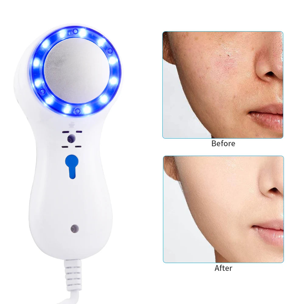 Cryotherapy Skin Cooling Machine Cold Compress Blue Photon Skincooler Facial Calming Care Ice Cooler Reduce Swelling Shrink Pore