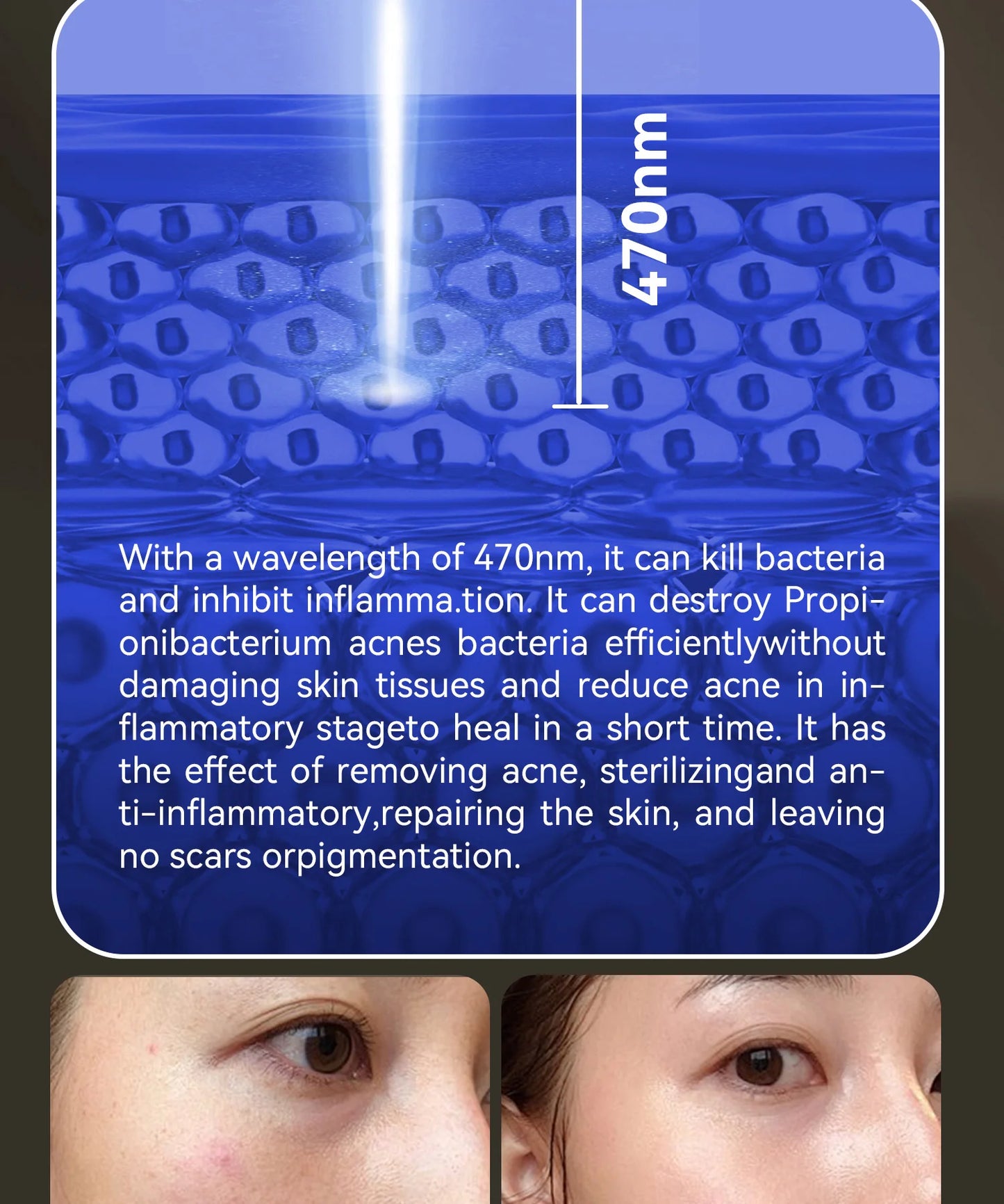 Hello Face Rechargeable Red Light Therapy Mask for Face & Neck  Infrared LED Mask Skincare Device for Glowing Skin